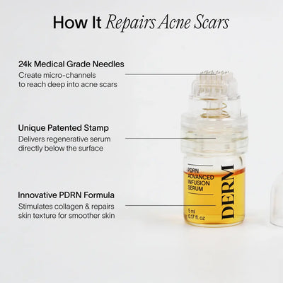 PDRN Advanced Infusion Treatment for Acne Scars