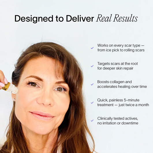 PDRN Advanced Infusion Treatment for Acne Scars