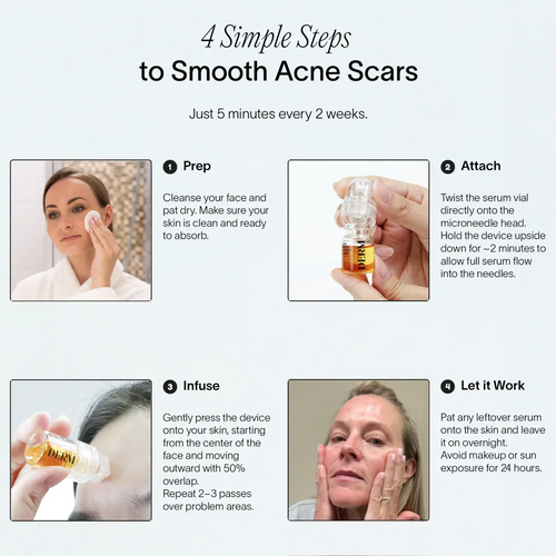PDRN Advanced Infusion Treatment for Acne Scars